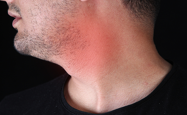 How do i get rid of a swollen lymph node behind my ear